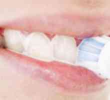 De ce gingii sângerau atunci când periați dinții: cauze și tratament