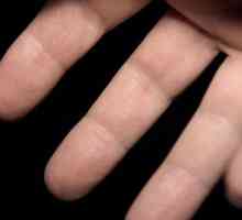 De ce sunt degetele de pe mâna stângă amorțite?