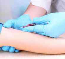 Pregătirea pentru un test de sânge biochimic: reguli și sfaturi