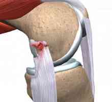 Ligamente legate de picior: simptome și tratament