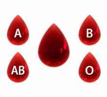 Reguli pentru determinarea tipului de sânge în conformitate cu sistemul ABO
