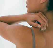 Cauza de acnee pe spatele femeilor. Metode de tratament