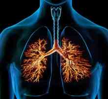 Cauze și simptome ale bronșitei obstructive cronice. Diagnosticul și tratamentul