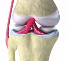 Cauzele și simptomele sinovitisului genunchiului