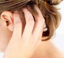 Cauze, simptome și tratamentul dermatitei seboreice pe cap