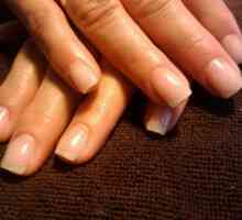 Stratificarea unghiilor pe mâini: cauze și tratament