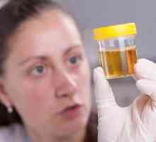 Care este cauza urinei tulbure la copii?