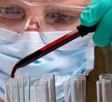 Teste serologice ale sângelui în diagnosticul bolilor