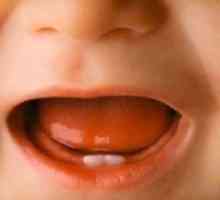 Simptomele dinților dentare la copii: merită îngrijorată părinții?