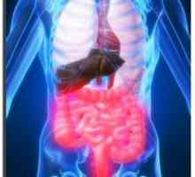 Sindromul intestinului iritabil: tratament, cauze, simptome