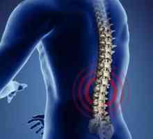 Spondiloza coloanei vertebrale lombare: cauze, simptome și metode de tratament