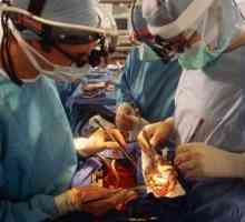 Transplantul de organe și țesuturi. Transplantul de organe în Rusia
