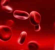 Nivelul hemoglobinei din sânge: norma și patologia