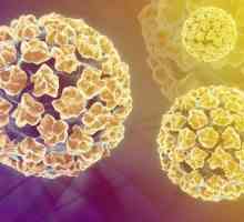 Tipurile HPV 16 și 18: cauze, diagnostice, simptome și tratament. Papilomavirus uman (HPV) tip…