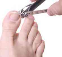 Cultivarea unghiilor pe picioare: cauze și metode de tratament