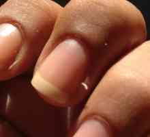 Burru pe degete: cauze și tratament