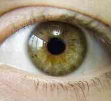 Ochii verzi-căprui: caracteristice