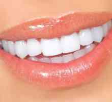 Dinți artificiali: tipuri și trăsături