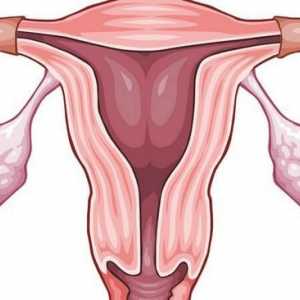Adenomioza uterului: semne și tratament, recenzii