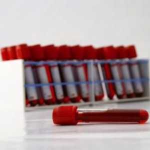 Test de sânge la un copil: decodare - poți să-l faci singur?