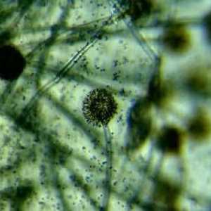Bacteriile și microbii sub microscop (foto)