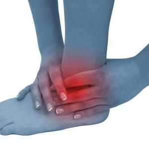 Boala care afectează glezna: artrita