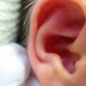 Ce trebuie să faceți dacă urechea: cauze de disconfort și modalități de eliminare a acesteia