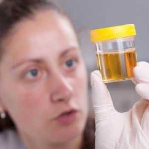 Ce este sarea în urina copiilor?