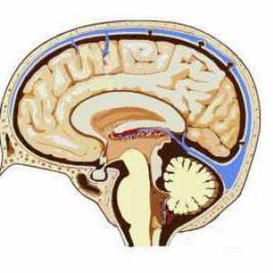 Ce sunt cisternele creierului?