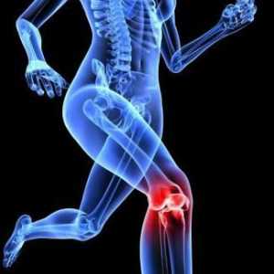 Ce este artroza deformată a articulației genunchiului?