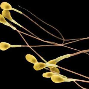 Ce este un spermatozoid? Caracteristicile jocului mascul