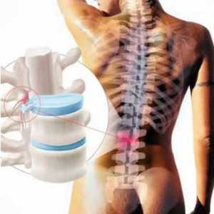 Modificări degenerative și distrofice ale coloanei vertebrale lombare: cauze și simptome