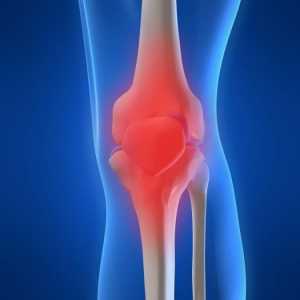 DOA articulații genunchi: cauze, simptome în diferite etape, tratament