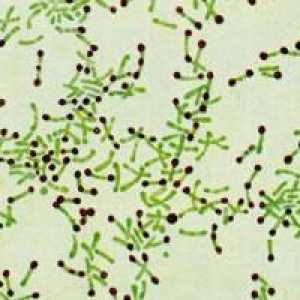 Bolile infecțioase: un agent cauzator al difteriei