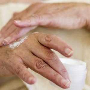Eczemă pe mâini. Cum se trateaza boala?