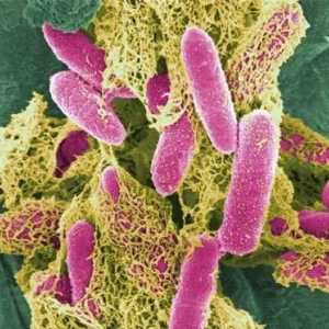 Cum se transmite Staphylococcus aureus? Grup de risc, prevenire