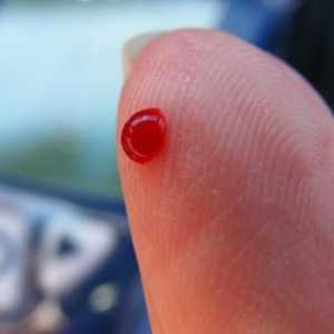 Cum să dați sânge dintr-un deget: algoritmul de manipulare