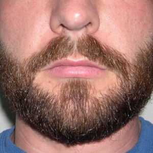 Cum de a accelera creșterea unei barbe? Sfaturi și trucuri