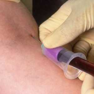 Care este norma limfocitelor din sângele femeilor?