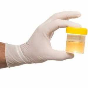 Analiza generală a urinei. Cum se colectează și se interpretează rezultatul?