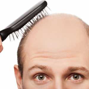 Alopecia areata: fotografii, cauze și tratament la adulți și copii