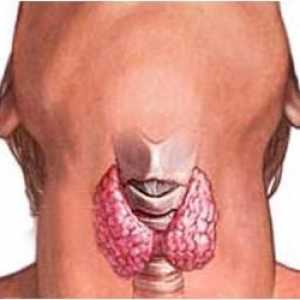 Principalul simptom al cancerului tiroidian