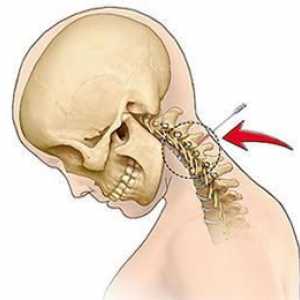 De ce apare dorsopatia coloanei vertebrale cervicale și cum se manifestă ea însăși?
