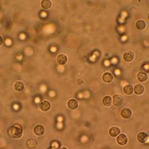 Bacteriile patogene în urină, ce înseamnă aceasta?