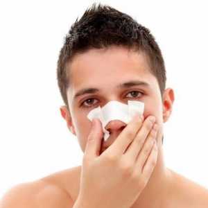 Fracturile nasului: simptomele și tratamentul acestora