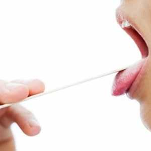 Primele semne ale cancerului de gât: cum să distingem cancerul de răceli