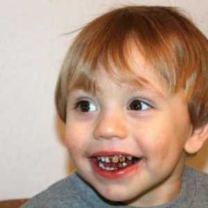 De ce sunt dinții negri ai copilului: cauze posibile, cum să rezolvați problema