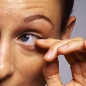 De ce ochiul stâng se răstoarnă: cauzele cele mai probabile