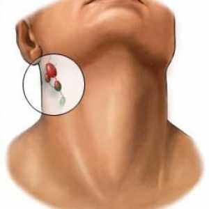 De ce au fost inflamate ganglionii limfatici în spatele urechilor?