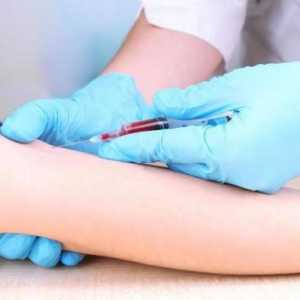 Pregătirea pentru un test de sânge biochimic: reguli și sfaturi